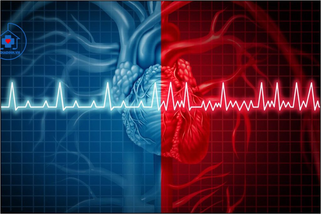 Giải pháp tự nhiên điều hòa mỡ máu và tim mạch là gì?